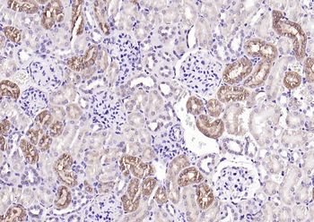 Cathepsin L antibody