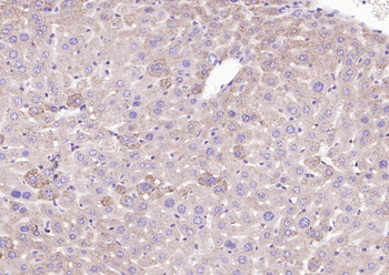 Cathepsin L antibody