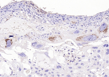 Cathepsin L antibody