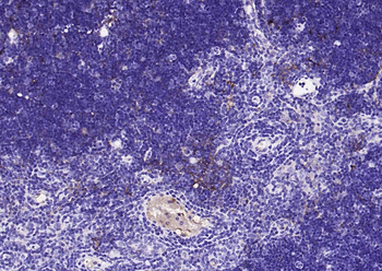 Cathepsin L antibody