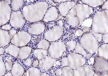 Cathepsin L antibody