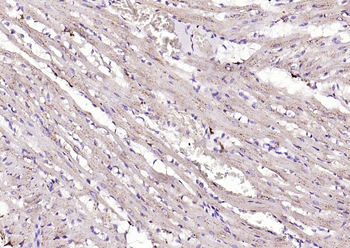 Cathepsin L antibody