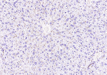 CD13 antibody