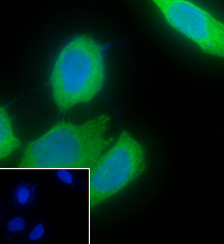 Keratin 6 antibody