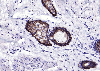 Keratin 6 antibody