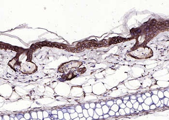 Keratin 6 antibody