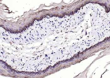 Keratin 6 antibody