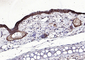 Keratin 6 antibody