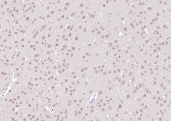 SPHK2 antibody