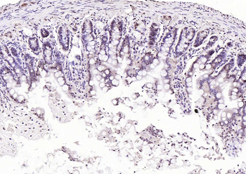 SPHK2 antibody