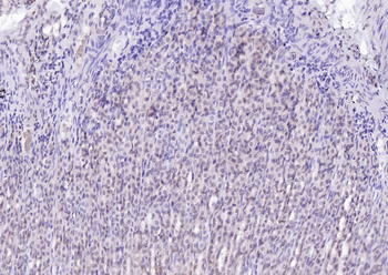 SPHK2 antibody