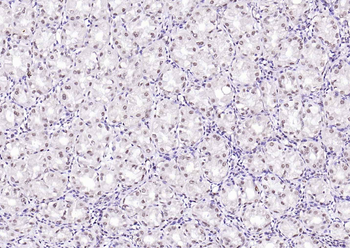 SPHK2 antibody