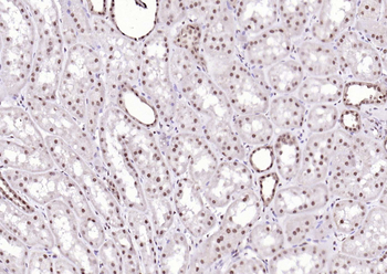 SPHK2 antibody