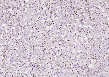 SPHK2 antibody