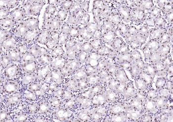 SPHK2 antibody