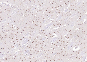 SPHK2 antibody