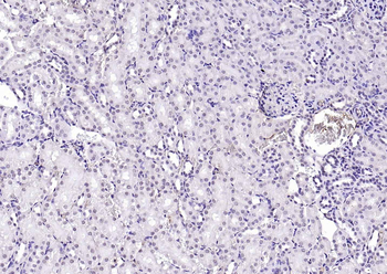 SPHK2 antibody