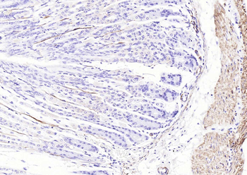 Desmin antibody