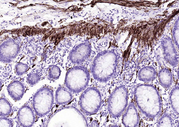 Desmin antibody