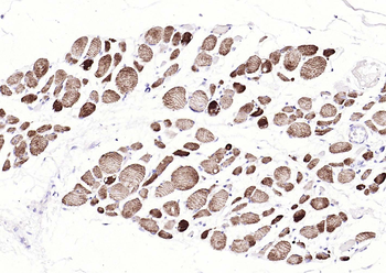 Desmin antibody