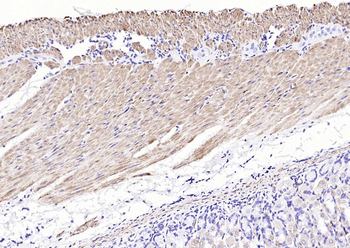 Desmin antibody