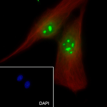 Nucleophosmin antibody