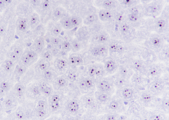 Nucleophosmin antibody