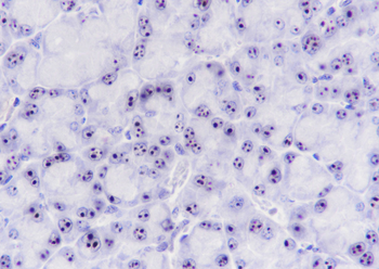 Nucleophosmin antibody