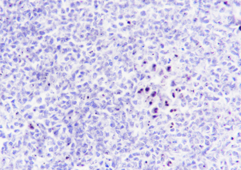 Nucleophosmin antibody