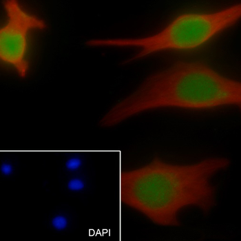 EZH2 antibody