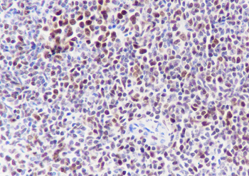 EZH2 antibody