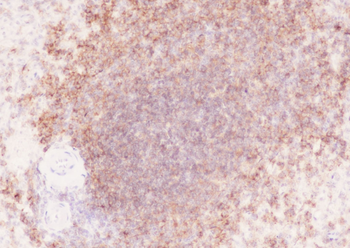 CD19 antibody