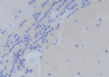 SNAP25 antibody