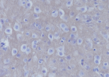 SNAP25 antibody