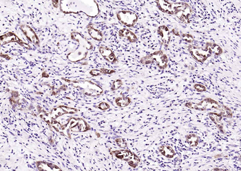 GSTP1 antibody