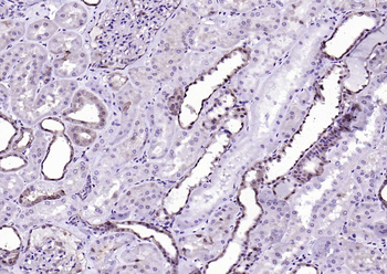 GSTP1 antibody