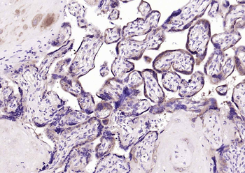 GSTP1 antibody