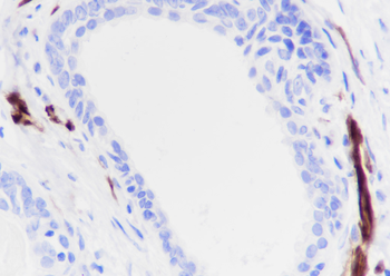 Calponin-1 antibody