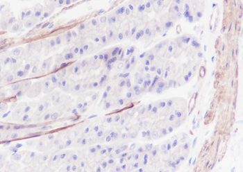 Calponin-1 antibody