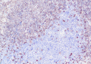 CD79b antibody