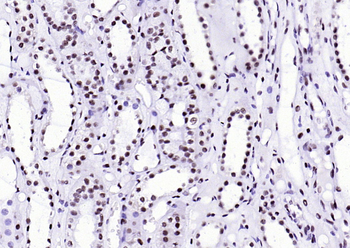 XRCC5/Ku80 antibody