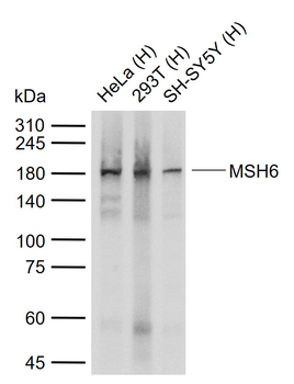 MSH6 antibody