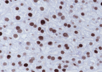 MSH6 antibody