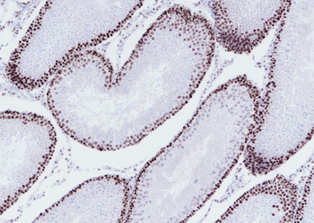 MSH6 antibody