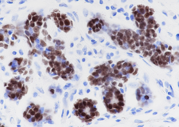 SOX-10 antibody