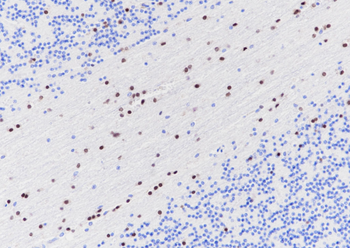 SOX-10 antibody