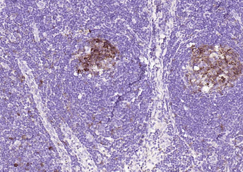 STMN1 antibody