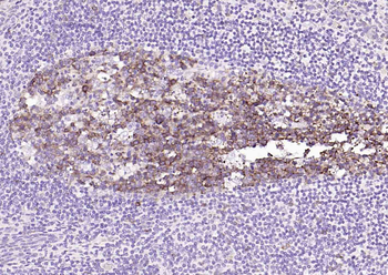 STMN1 antibody