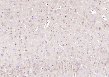 STMN1 antibody