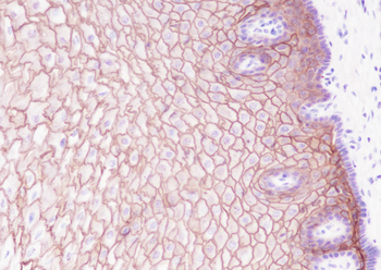 LYPD3 antibody